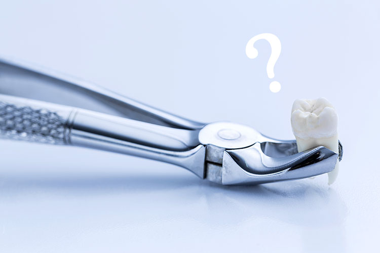 親知らずの抜歯に関するよくあるご質問